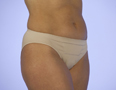 classic_nude_2010_atn (27K)